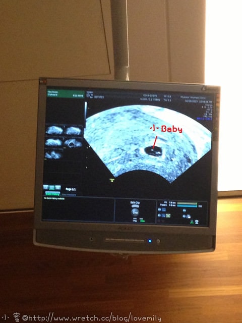 20241011-76crc