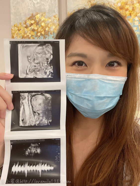 【３】Sunway Medical Centre Velocity (SMCV)產檢 <沒做羊膜穿刺的一般產檢，尿糖貌似偏高>《17W4D》
